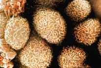 células de câncer de cólon