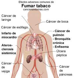 fumar provoca cancer de garganta